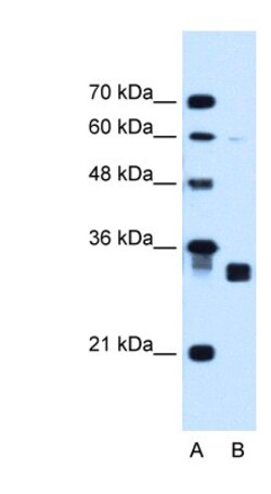 CBR1 Antibody, Novus Biologicals 0.1mg; Unlabeled:Antibodies, Polyclonal
