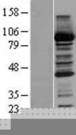 Novus Biologicals&trade;&nbsp;CBR1 Overexpression Lysate