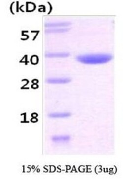 Novus Biologicals&trade;&nbsp;Recombinant Human CBR3 His Protein