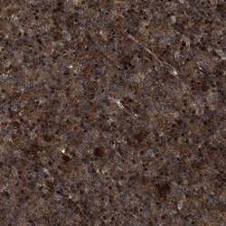 CBR3 Antibody, Novus Biologicals 0.1 mL | Buy Online | Novus Biologicals | Fisher Scientific