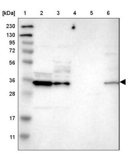 CBR3 Antibody, Novus Biologicals 0.1 mL | Buy Online | Novus Biologicals | Fisher Scientific