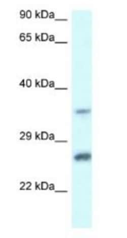 CBR4 Antibody, Novus Biologicals:Antibodies:Primary Antibodies