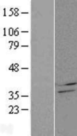 Novus Biologicals&trade;&nbsp;CBR4 Overexpression Lysate