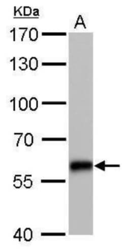 CBS Antibody (519), Novus Biologicals 0.1mL; Unlabeled:Antibodies, Monoclonal