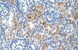 CBS Antibody, Novus Biologicals 0.1mg; Unlabeled:Antibodies, Polyclonal
