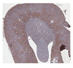 CBS Antibody, Novus Biologicals 0.1mg; Unlabeled:Antibodies, Polyclonal