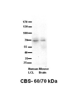 CBS Antibody, Novus Biologicals 0.1mg; Unlabeled:Antibodies, Polyclonal