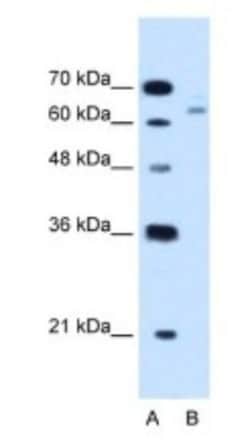 CBS Antibody, Novus Biologicals 0.1mg; Unlabeled:Antibodies, Polyclonal