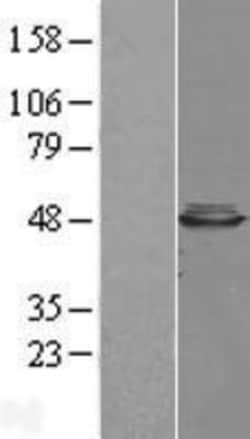 Novus Biologicals&trade;&nbsp;CBWD1 Overexpression Lysate