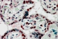 CBX1 Antibody, Novus Biologicals 0.1 mg | Buy Online | Novus Biologicals | Fisher Scientific