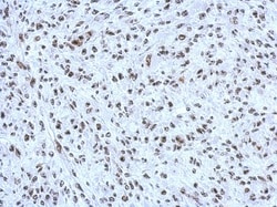 CBX1 Antibody, Novus Biologicals 0.1 mL | Buy Online | Novus Biologicals | Fisher Scientific