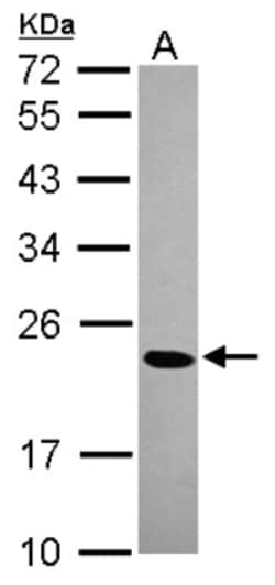 CBX1 Antibody, Novus Biologicals 0.1 mL | Buy Online | Novus Biologicals | Fisher Scientific