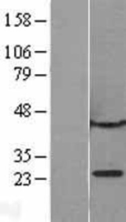Novus Biologicals&trade;&nbsp;CBX1 Overexpression Lysate