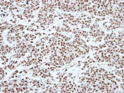 CBX3 Antibody, Novus Biologicals 0.1mL; Unlabeled:Antibodies, Polyclonal