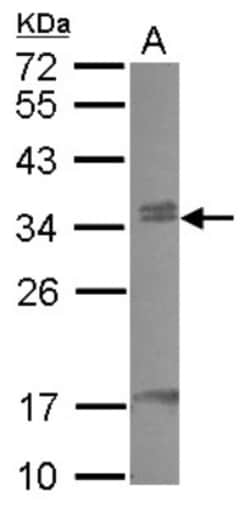 CBX7 Antibody, Novus Biologicals 0.1mL; Unlabeled:Antibodies, Polyclonal