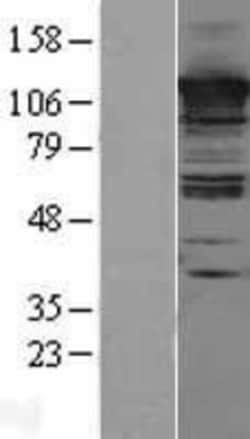Novus Biologicals&trade;&nbsp;CC2D1A Overexpression Lysate