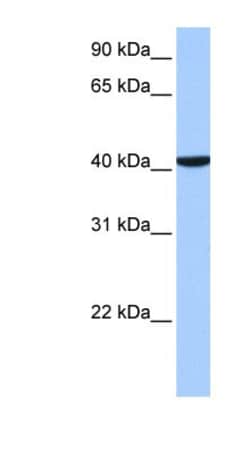 CC2D1B Antibody, Novus Biologicals 100&mu;L; Unlabeled:Antibodies, Polyclonal