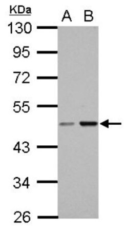 CC2D2B Antibody, Novus Biologicals 0.1mL; Unlabeled:Antibodies, Polyclonal