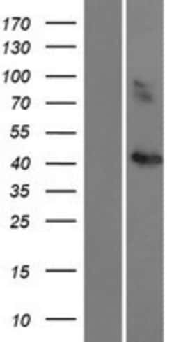 Novus Biologicals™ CCBE1 Overexpression Lysate