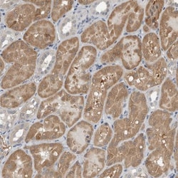 Cysteine Conjugate beta-Lyase/CCBL1 Antibody, Novus Biologicals 25 &mu;L;
