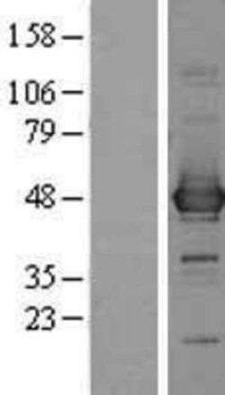 Novus Biologicals&trade;&nbsp;Cysteine Conjugate beta-Lyase/CCBL1 Overexpression Lysate