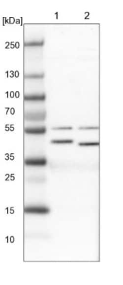 CCBL2 Antibody, Novus Biologicals 25 &mu;L | Buy Online | Novus Biologicals | Fisher Scientific
