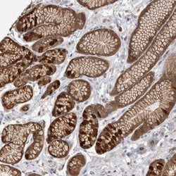 CCBL2 Antibody, Novus Biologicals 25 &mu;L; Unlabeled:Antibodies, Polyclonal