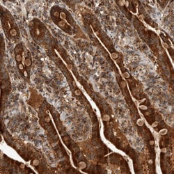 CCBL2 Antibody, Novus Biologicals 25 &mu;L | Buy Online | Novus Biologicals | Fisher Scientific