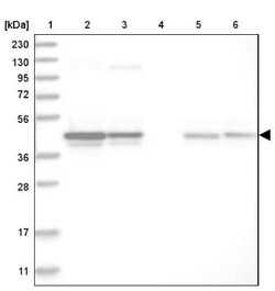 CCBL2 Antibody, Novus Biologicals 25 &mu;L; Unlabeled:Antibodies, Polyclonal