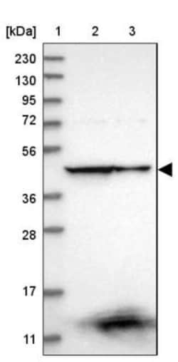 CCBL2 Antibody, Novus Biologicals 25 &mu;L | Buy Online | Novus Biologicals | Fisher Scientific