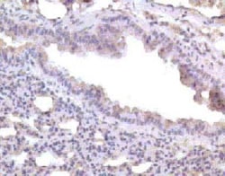 CC Chemokine Receptor D6 Antibody 0.025 mg; Unconjugated:Antibodies, Polyclonal