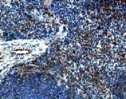 CC Chemokine Receptor D6 Antibody 0.025 mg; Unconjugated:Antibodies, Polyclonal