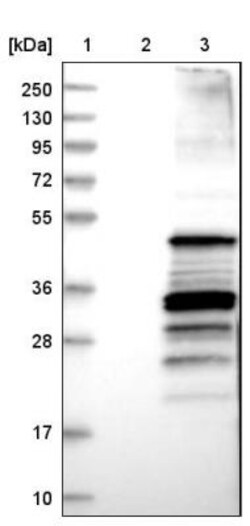 CC Chemokine Receptor D6 Antibody, Novus Biologicals 0.1mL; Unlabeled:Antibodies,