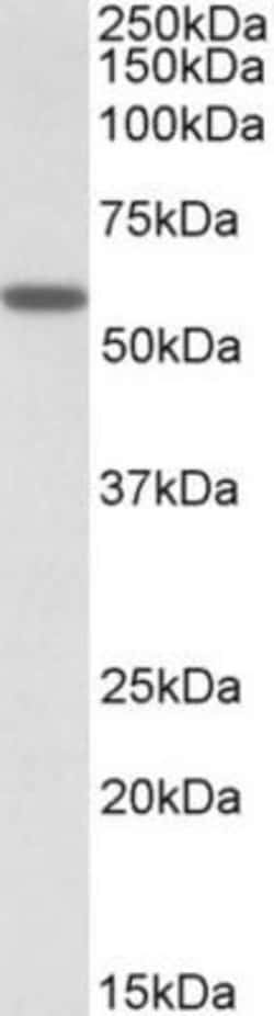 Ccd1/DIXDC1 Antibody, Novus Biologicals 0.1 mg | Buy Online | Novus Biologicals | Fisher Scientific