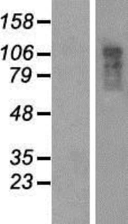 Novus Biologicals&trade;&nbsp;URB/CCD80 Overexpression Lysate