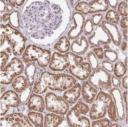 CCDC101 Antibody, Novus Biologicals:Antibodies:Primary Antibodies