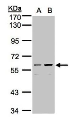 CCDC102B Antibody, Novus Biologicals 0.1mL; Unlabeled:Antibodies, Polyclonal