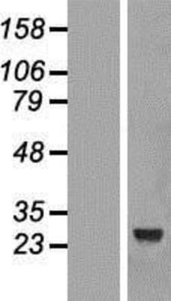 Novus Biologicals&trade;&nbsp;CCDC103 Overexpression Lysate
