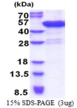 Novus Biologicals&trade;&nbsp;Recombinant Human CCDC104 His Protein