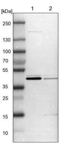 CCDC104 Antibody, Novus Biologicals:Antibodies:Primary Antibodies