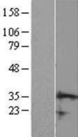 Novus Biologicals&trade;&nbsp;CCDC106 Overexpression Lysate