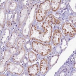 CCDC106 Antibody, Novus Biologicals 0.1mL; Unlabeled:Antibodies, Polyclonal