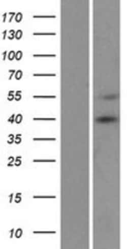 Novus Biologicals&trade;&nbsp;CCDC109A Overexpression Lysate