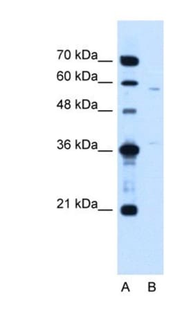 CCDC112 Antibody, Novus Biologicals 100&mu;L; Unlabeled:Antibodies, Polyclonal