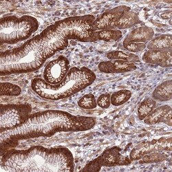 CCDC112 Antibody, Novus Biologicals 0.1mL; Unlabeled:Antibodies, Polyclonal