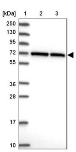 CCDC112 Antibody, Novus Biologicals 0.1mL; Unlabeled:Antibodies, Polyclonal