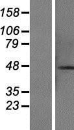 Novus Biologicals&trade;&nbsp;CCDC113 Overexpression Lysate
