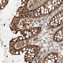CCDC115 Antibody, Novus Biologicals 25 &mu;L; Unlabeled:Antibodies, Polyclonal