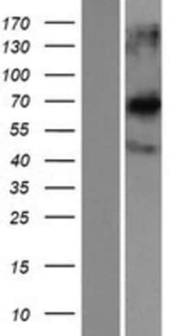 Novus Biologicals&trade;&nbsp;CCDC120 Overexpression Lysate