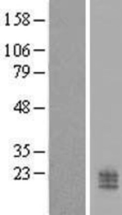 Novus Biologicals&trade;&nbsp;CCDC126 Overexpression Lysate